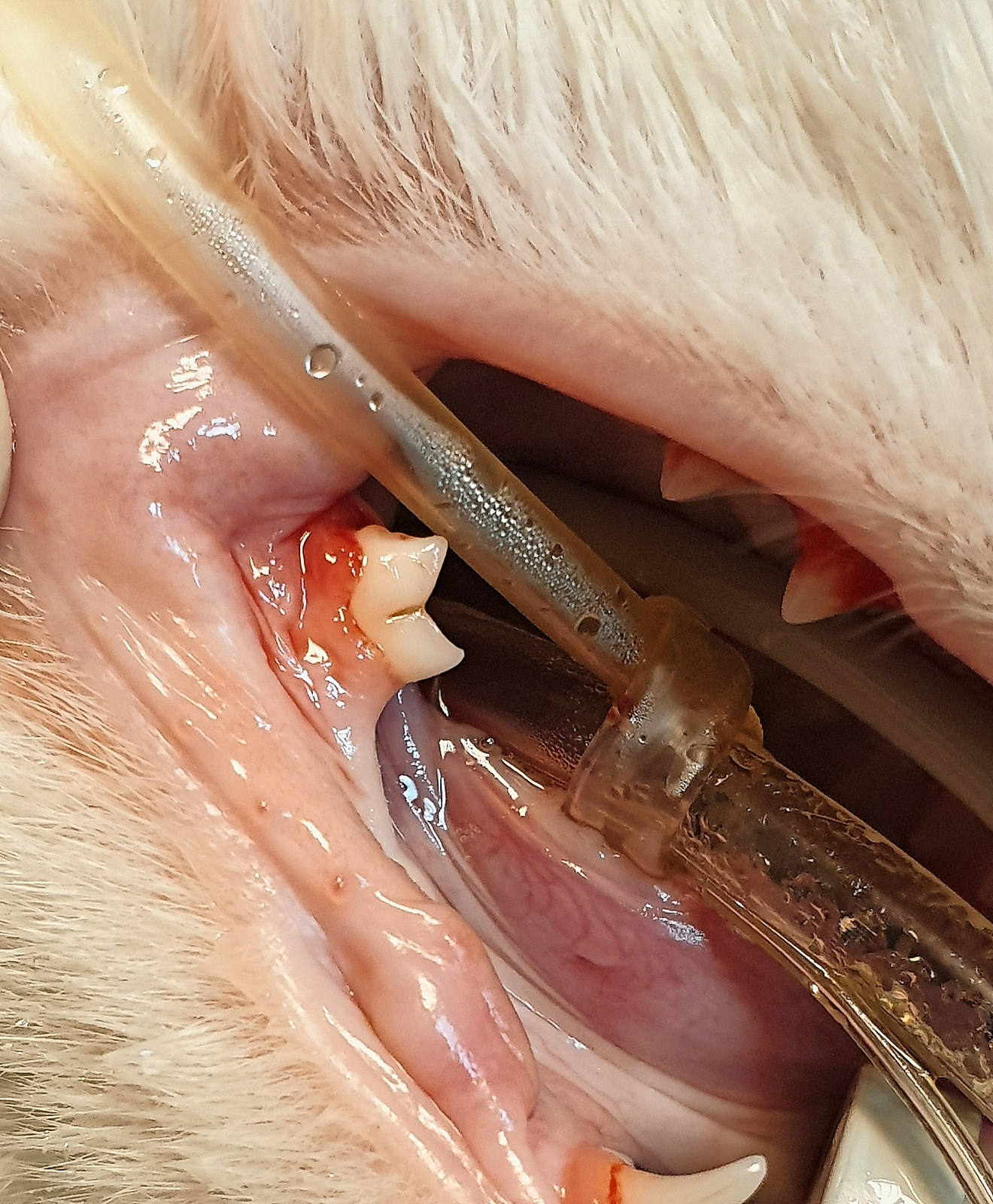 Resorptive Läsion des Typ 1: Klinisch ist am betroffenen Zahn M1 des Unterkiefers lediglich die Gingivitis erkennbar.